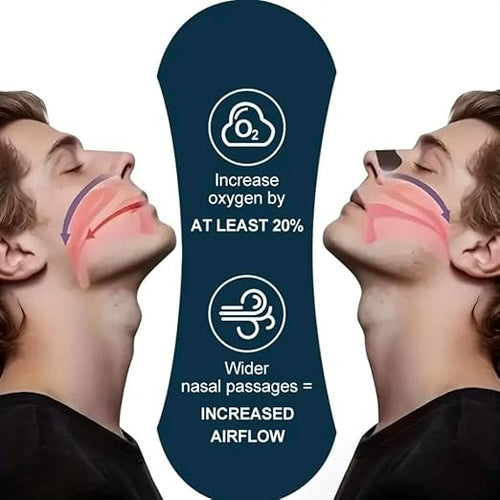 100 Pcs Advanced Black Nasal Strips